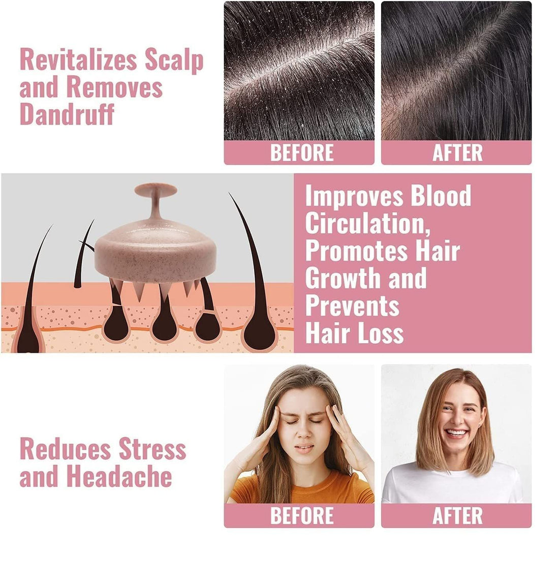 Scalp Massager Shampoo Brush - Brown (200 g)